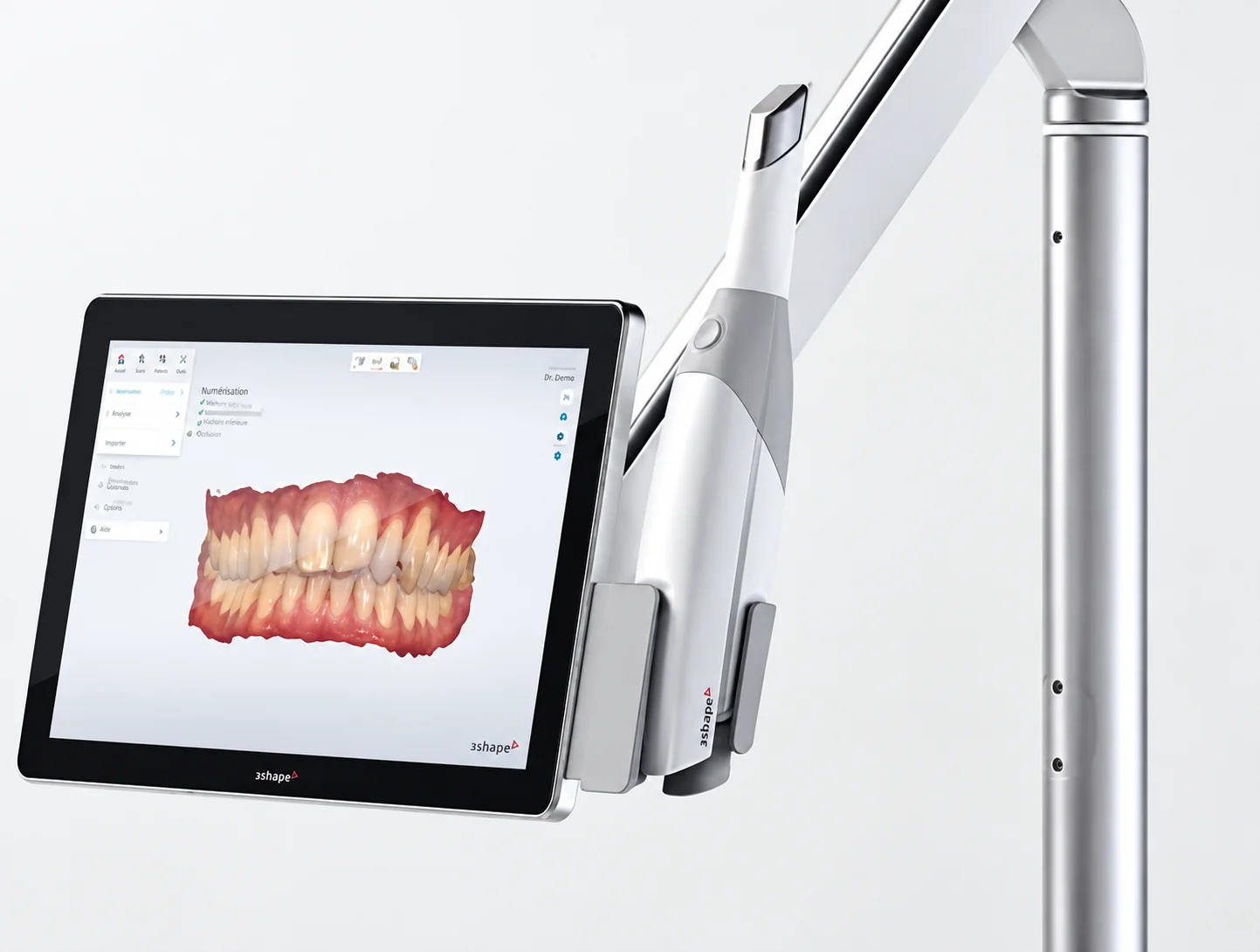 Scanner intra-oral et modèle 3D des dents affiché à l'écran, cabinet d'orthodontie de Nanterre